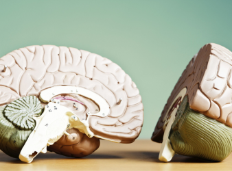 Iron Overload, Neurodegeneration, Chronoferroptosis, Alzheimer's Disease, Parkinson's Disease, Neurology, Brain Health, Neuronal Resilience, Ferroptosis, Iron Accumulation, Aging Brain, Oxidative Stress, Neuroscience Research, Cell Death Discovery, Salk Institute, neurodegenerative disease research, lipid peroxidation, iron homeostasis, neuron health, neuroscience research, neuroprotection