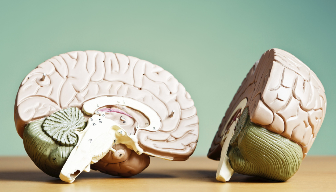 Iron Overload, Neurodegeneration, Chronoferroptosis, Alzheimer's Disease, Parkinson's Disease, Neurology, Brain Health, Neuronal Resilience, Ferroptosis, Iron Accumulation, Aging Brain, Oxidative Stress, Neuroscience Research, Cell Death Discovery, Salk Institute, neurodegenerative disease research, lipid peroxidation, iron homeostasis, neuron health, neuroscience research, neuroprotection