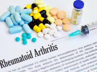 Rheumatoid Arthritis, SPP1hi Macrophages, Synovial Tissue Growth, Autoimmune Disease, Joint Inflammation, IL-6 Signaling, Rheumatology Research, Pannus Formation, Fibroblasts, Fibrin Scaffold, Tissue Remodeling, Chronic Inflammation, Joint Damage, Immunology, Science Translational Medicine, fibroblasts in rheumatoid arthritis, fibrin scaffold, chronic joint disease, rheumatology research, immune cells in arthritis, rheumatoid arthritis progression