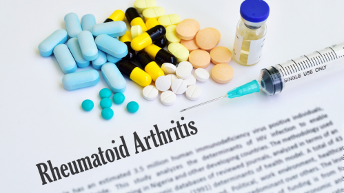 Rheumatoid Arthritis, SPP1hi Macrophages, Synovial Tissue Growth, Autoimmune Disease, Joint Inflammation, IL-6 Signaling, Rheumatology Research, Pannus Formation, Fibroblasts, Fibrin Scaffold, Tissue Remodeling, Chronic Inflammation, Joint Damage, Immunology, Science Translational Medicine, fibroblasts in rheumatoid arthritis, fibrin scaffold, chronic joint disease, rheumatology research, immune cells in arthritis, rheumatoid arthritis progression