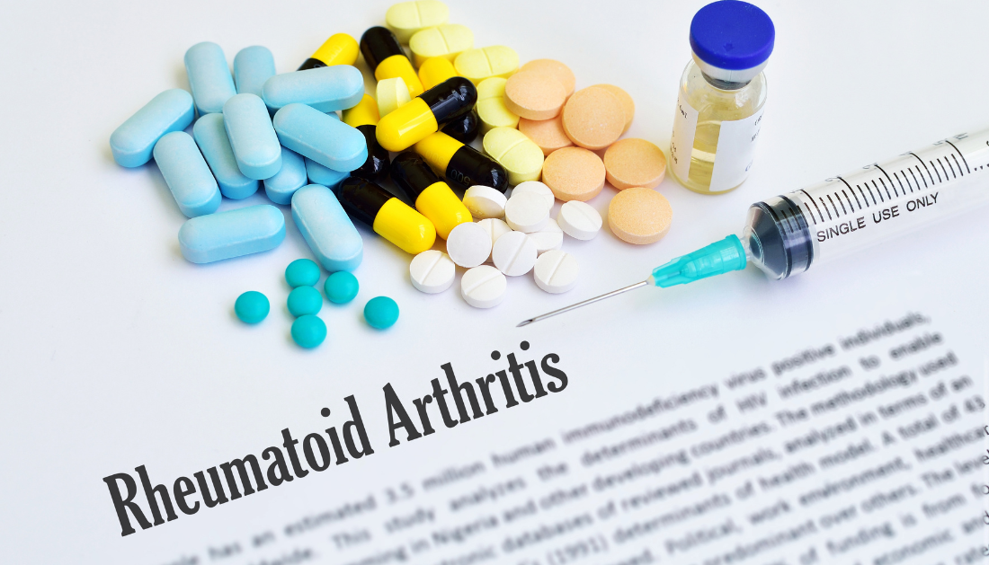 Rheumatoid Arthritis, SPP1hi Macrophages, Synovial Tissue Growth, Autoimmune Disease, Joint Inflammation, IL-6 Signaling, Rheumatology Research, Pannus Formation, Fibroblasts, Fibrin Scaffold, Tissue Remodeling, Chronic Inflammation, Joint Damage, Immunology, Science Translational Medicine, fibroblasts in rheumatoid arthritis, fibrin scaffold, chronic joint disease, rheumatology research, immune cells in arthritis, rheumatoid arthritis progression