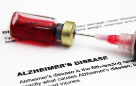 Alzheimer's Disease, Blood Biomarker, Plasma Neurofilament Light Chain, NfL, Neurology, Dementia, Neurodegeneration, Brain Medicine, Cognitive Decline, Alzheimer's Biomarkers, Precision Medicine, Blood Test, Hippocampal Atrophy, Neuroinflammation, FDG PET, MRI Brain, Amyloid, Tau Protein, Clinical Research, Brain Health, plasma NfL, brain health, Alzheimer's diagnosis, hippocampal atrophy, amyloid biomarkers, tau protein, precision medicine