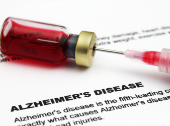 Alzheimer's Disease, Blood Biomarker, Plasma Neurofilament Light Chain, NfL, Neurology, Dementia, Neurodegeneration, Brain Medicine, Cognitive Decline, Alzheimer's Biomarkers, Precision Medicine, Blood Test, Hippocampal Atrophy, Neuroinflammation, FDG PET, MRI Brain, Amyloid, Tau Protein, Clinical Research, Brain Health, plasma NfL, brain health, Alzheimer's diagnosis, hippocampal atrophy, amyloid biomarkers, tau protein, precision medicine