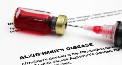 Alzheimer's Disease, Blood Biomarker, Plasma Neurofilament Light Chain, NfL, Neurology, Dementia, Neurodegeneration, Brain Medicine, Cognitive Decline, Alzheimer's Biomarkers, Precision Medicine, Blood Test, Hippocampal Atrophy, Neuroinflammation, FDG PET, MRI Brain, Amyloid, Tau Protein, Clinical Research, Brain Health, plasma NfL, brain health, Alzheimer's diagnosis, hippocampal atrophy, amyloid biomarkers, tau protein, precision medicine