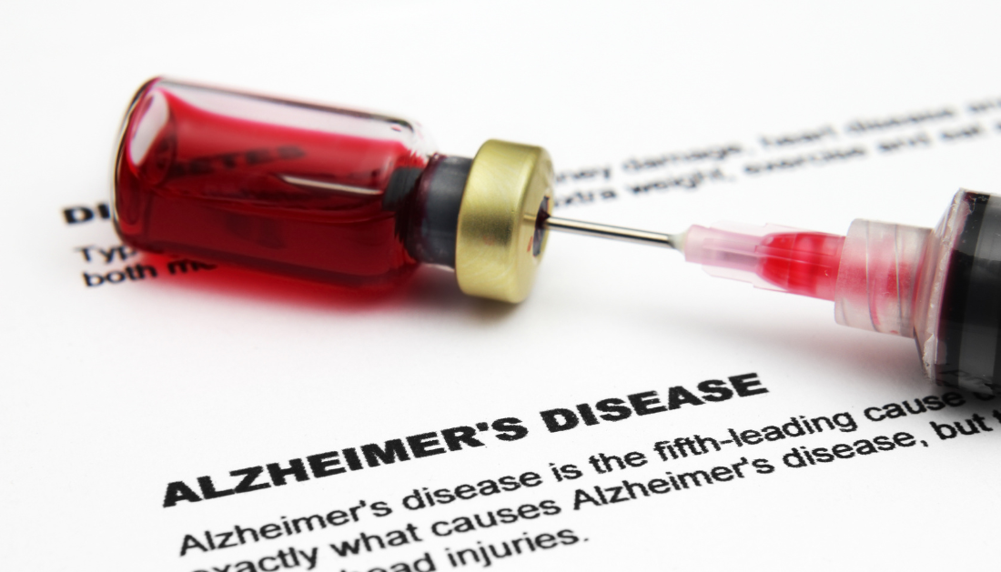 Alzheimer's Disease, Blood Biomarker, Plasma Neurofilament Light Chain, NfL, Neurology, Dementia, Neurodegeneration, Brain Medicine, Cognitive Decline, Alzheimer's Biomarkers, Precision Medicine, Blood Test, Hippocampal Atrophy, Neuroinflammation, FDG PET, MRI Brain, Amyloid, Tau Protein, Clinical Research, Brain Health, plasma NfL, brain health, Alzheimer's diagnosis, hippocampal atrophy, amyloid biomarkers, tau protein, precision medicine
