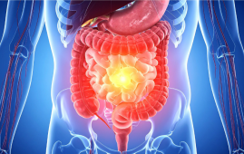 Chronic Xanthan Gum Consumption, Xanthan Gum, Colon Inflammation, Gut Health, Gut Microbiota, Dysbiosis, Intestinal Barrier, Claudin-2, TNF-alpha, IL-1β, PLOS One, Gastroenterology, Food Additives, Dysphagia, Necrotizing Enterocolitis, Intestinal Inflammation, Processed Foods, Nutrition Research, Digestive Health, Preclinical Study, dysbiosis, inflammatory cytokines, IL-1β, TNF-alpha, food additives, necrotizing enterocolitis, gut health, PLOS One study