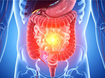 Chronic Xanthan Gum Consumption, Xanthan Gum, Colon Inflammation, Gut Health, Gut Microbiota, Dysbiosis, Intestinal Barrier, Claudin-2, TNF-alpha, IL-1β, PLOS One, Gastroenterology, Food Additives, Dysphagia, Necrotizing Enterocolitis, Intestinal Inflammation, Processed Foods, Nutrition Research, Digestive Health, Preclinical Study, dysbiosis, inflammatory cytokines, IL-1β, TNF-alpha, food additives, necrotizing enterocolitis, gut health, PLOS One study