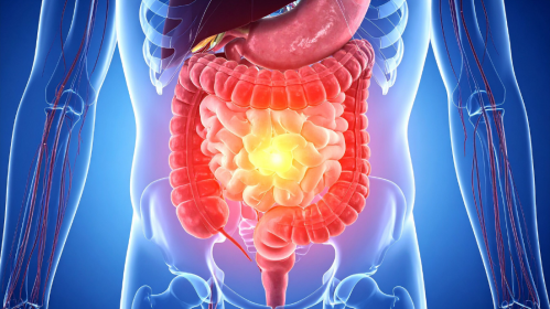 Chronic Xanthan Gum Consumption, Xanthan Gum, Colon Inflammation, Gut Health, Gut Microbiota, Dysbiosis, Intestinal Barrier, Claudin-2, TNF-alpha, IL-1β, PLOS One, Gastroenterology, Food Additives, Dysphagia, Necrotizing Enterocolitis, Intestinal Inflammation, Processed Foods, Nutrition Research, Digestive Health, Preclinical Study, dysbiosis, inflammatory cytokines, IL-1β, TNF-alpha, food additives, necrotizing enterocolitis, gut health, PLOS One study