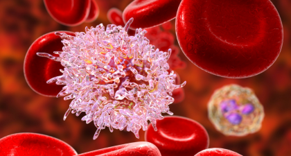 Autophagy Modulation, Cisplatin-Resistant Gastric Cancer, Gastric Cancer, Oncology, Medical Oncology, Chemotherapy Resistance, Cancer Research, Precision Medicine, Immunotherapy, Radiotherapy, Targeted Therapy, Tumor Microenvironment, MicroRNA, Cancer Therapeutics, Gastrointestinal Oncology, precision medicine, immunotherapy, tumor microenvironment, apoptosis, molecular targets, oncology research, gastric cancer therapy