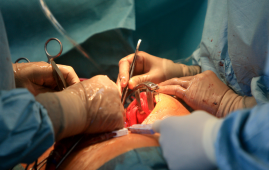 Intravenous Iron, Heart Surgery, Cardiac Surgery, Preoperative Anemia, Red Blood Cell Transfusion, Blood Management, Patient Blood Management, Perioperative Care, Hemoglobin, Cardiology, Cardiothoracic Surgery, Hematology, Anesthesiology, Surgical Recovery, Clinical Trial, Perioperative Anemia, Hemoglobin Optimization, Elective Cardiac Surgery, Cardiothoracic Surgery, Perioperative Care, Clinical Trial