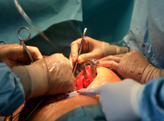Intravenous Iron, Heart Surgery, Cardiac Surgery, Preoperative Anemia, Red Blood Cell Transfusion, Blood Management, Patient Blood Management, Perioperative Care, Hemoglobin, Cardiology, Cardiothoracic Surgery, Hematology, Anesthesiology, Surgical Recovery, Clinical Trial, Perioperative Anemia, Hemoglobin Optimization, Elective Cardiac Surgery, Cardiothoracic Surgery, Perioperative Care, Clinical Trial