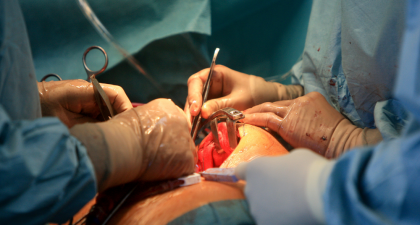 Intravenous Iron, Heart Surgery, Cardiac Surgery, Preoperative Anemia, Red Blood Cell Transfusion, Blood Management, Patient Blood Management, Perioperative Care, Hemoglobin, Cardiology, Cardiothoracic Surgery, Hematology, Anesthesiology, Surgical Recovery, Clinical Trial, Perioperative Anemia, Hemoglobin Optimization, Elective Cardiac Surgery, Cardiothoracic Surgery, Perioperative Care, Clinical Trial