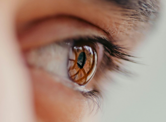 Laser Blended Vision, Presbyopia, Refractive Surgery, Ophthalmology, Eye Surgery, Vision Correction, Eye Health, Ocular Dominance, Patient Selection, Phoropter, Near Vision, Distance Vision, ESCRS, Refractive Errors, Ophthalmic Surgery, eye test, phoropter, near vision correction, distance vision correction, ophthalmology, patient selection