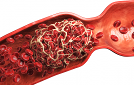 Coffee Consumption, coffee consumption and recurrent VTE, recurrent venous thromboembolism, coffee and blood clots, recurrent VTE risk, coffee consumption and VTE, venous thromboembolism recurrence, blood clot recurrence, deep vein thrombosis (DVT), pulmonary embolism (PE), provoked VTE, unprovoked VTE, VTE risk factors, anticoagulation therapy, thrombosis research, recurrent blood clots